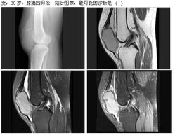 2013年高級衛生專業技術資格考試放射醫學強化練習題及答案解析（1月30日·放射衛生技術服務專題）